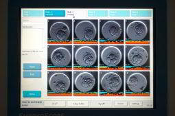 Embryoscope es un registro de imágenes y vídeos de tu futuro bebé desde sus inicios biológicos