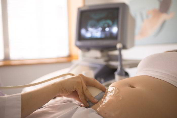 gravidanza con sperma donato