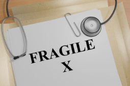 sindrome dell X fragile