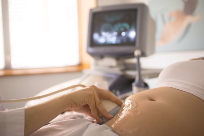 Monitorización Test Prenatal No Invasivo
