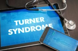 Sindrome di Turner: Sintomi, Diagnosi e Opzioni di Trattamento