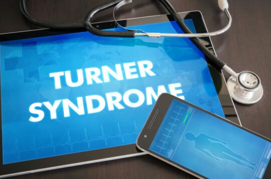 Sindrome di Turner: Sintomi, Diagnosi e Opzioni di Trattamento